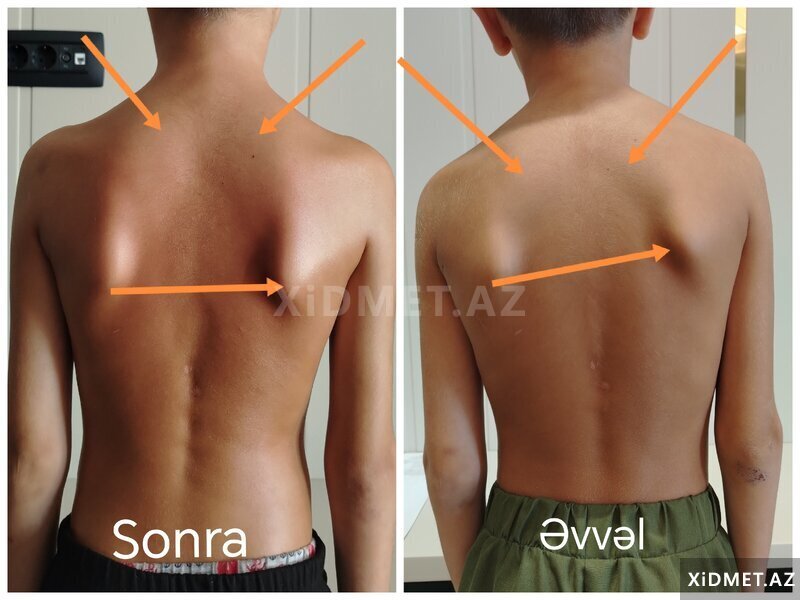 Hər növ masaj Hər növ masaj