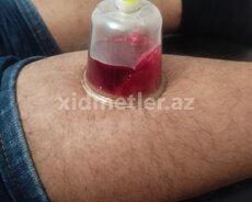 Hicama Zeli Tebii müaliceler